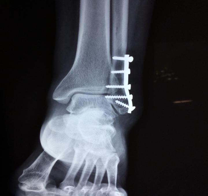 ankle-2253057_1920_0.jpg