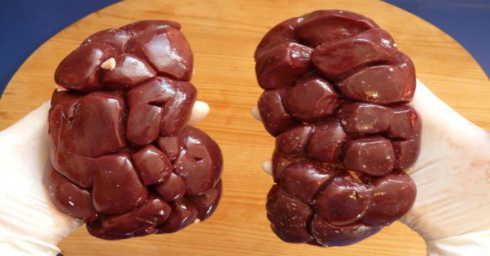 beef-kidney-ga32379f02_1920_0.jpg