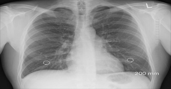 diagnosis-g40d17a1f3_1920_0.jpg