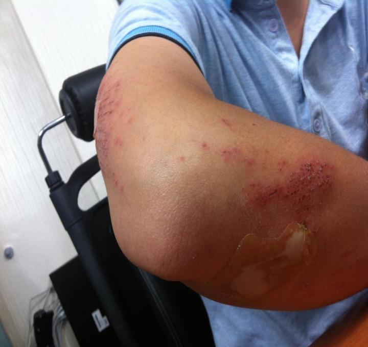 injury-199025_1920_1_0.jpg