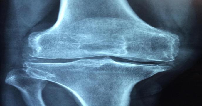 knee-gea56f8a52_1920_0.jpg
